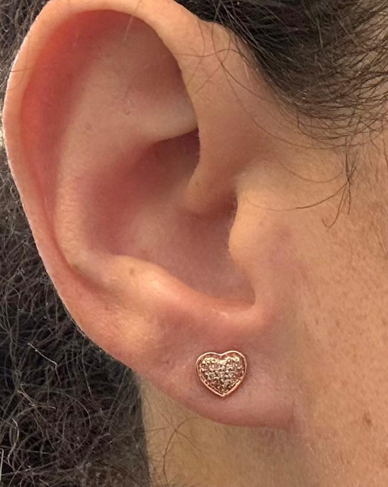 Broquel 14k AR780
